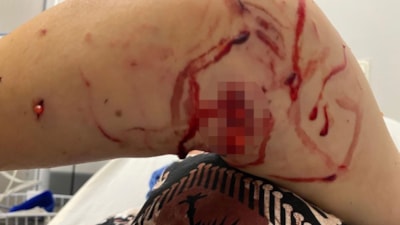 Kocaeli'de başıboş köpek dehşeti: Kadını parçaladılar