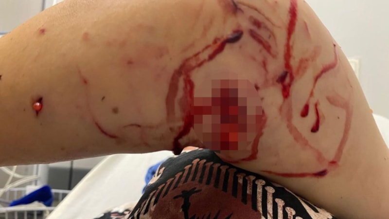 Kocaeli'de başıboş köpek dehşeti: Kadını parçaladılar