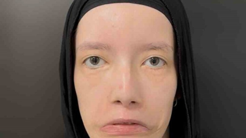 23 Yılı Mimiksiz Geçirdi: Türk Doktorların Operasyonuyla İlk Kez Gülümsedi