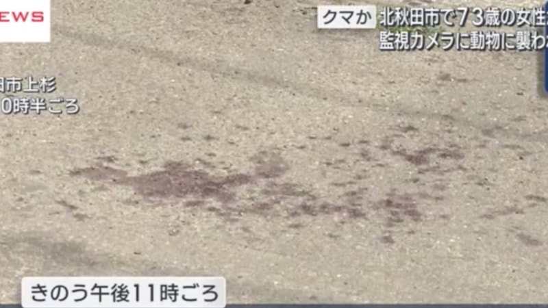 Japonya'da 73 yaşındaki kadına ayı saldırdı