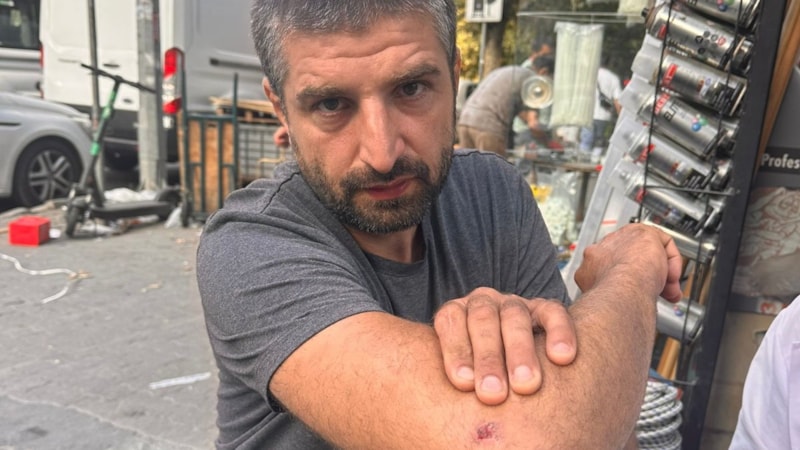 İstanbul'da motosiklet sürücüsü ölümden döndü