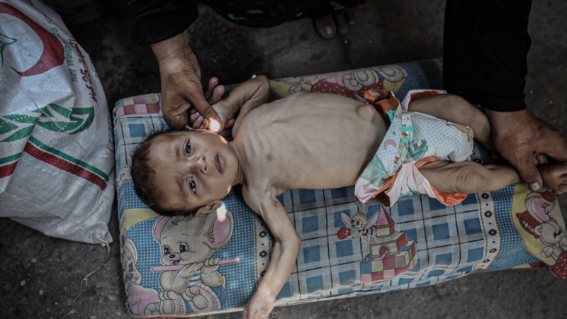 Gazze'de İsrail saldırısında hayatını kaybedenlerin en az yüzde 30'u çocuk