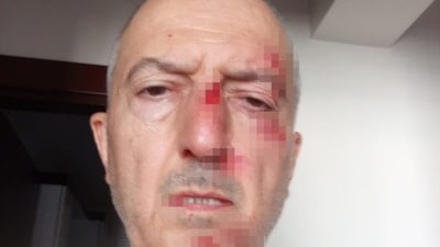 Afyonkarahisar'da karısı evlerini habersiz satınca sokakta kaldı: Ardından darbedildi