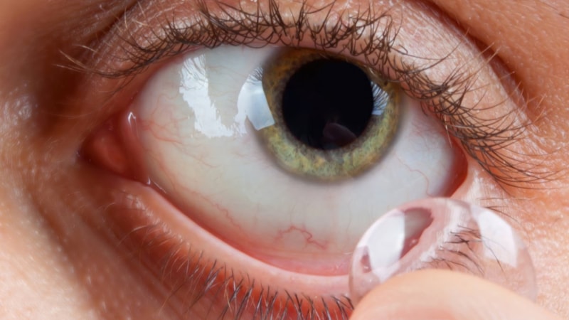 Kontakt lens kullanıyorsanız bu 6 kuralı uygulayın: Hayat kurtarıyor
