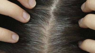 Saçlarınız erken beyazlıyorsa dikkat! Bu uyarılara kulak verin!