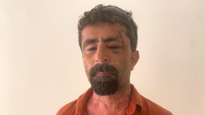 Antalya'da babaevine dönen eşini takip etti: Tartıştığı kayınpederini darbetti