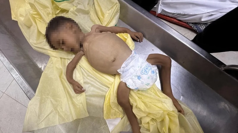 Gazze'de gıda krizi: Son 24 saatte 8 kişi daha açlıktan hayatını kaybetti