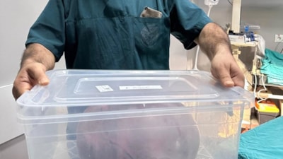 Trabzon'da yumurtalıklarından 9 kiloluk kitle çıktı