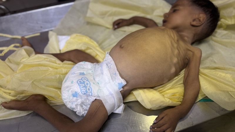 Gazze'de 4 kişi daha açlıktan hayatını kaybetti