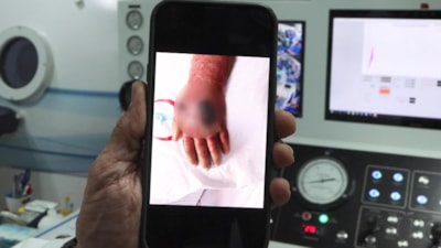 İstanbul'da hırsızın ısırığı kolundan ediyordu: Vaka literatüre girmeye aday