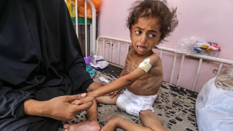 Gazze’de kıtlık can almaya devam ediyor: Çocuklar ölüm tehlikesi altında