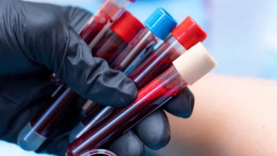 Araştırmalar ortaya koydu: Bu kan grubuna sahip kişiler yaşlanmıyor