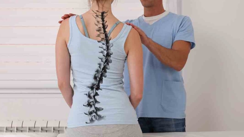 Skolyoz nedir? Kimlerde görülür, nasıl tedavi edilir?