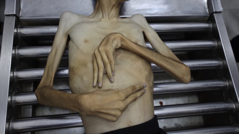 Gazze'de soykırım: 3 Filistinli daha açlıktan öldü