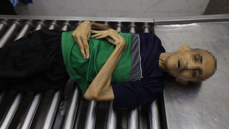 ABD: BM'nin 'Gazze'de kıtlık var' raporu dürüst değil