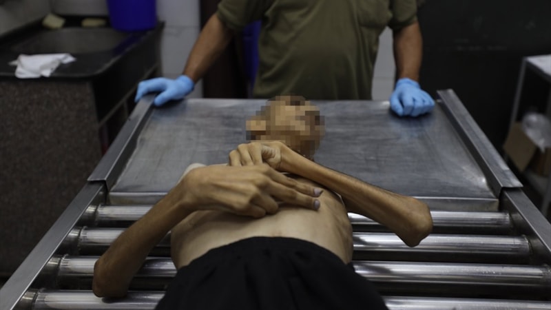 Gazze'de gıda krizi: Son 3 haftada bin yetişkin yetersiz beslenme nedeniyle hastaneye başvurdu