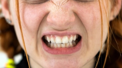 Dişlerinizi sıkmayın: Migrene neden oluyor