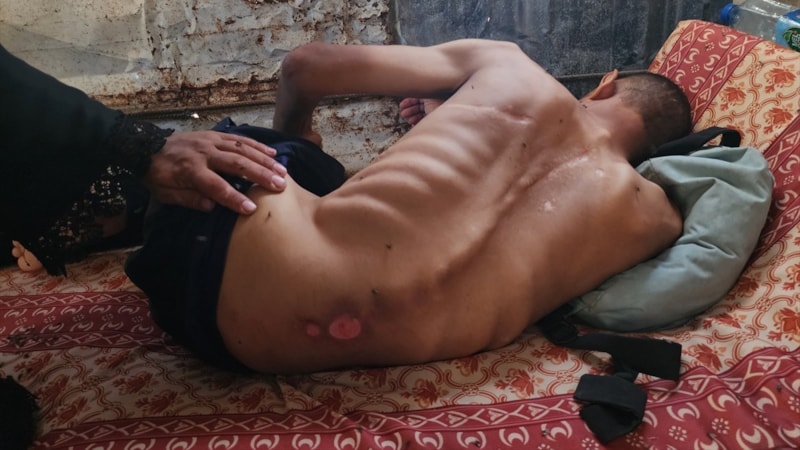 Gazze'de 6 kişi daha açlıktan hayatını kaybetti