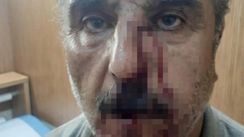 Denizli'de emekli öğretmen ile doktorun mesai kavgası