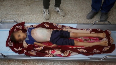 Gazze'de soykırım: 8 yaşındaki çocuk açlıktan hayatını kaybetti