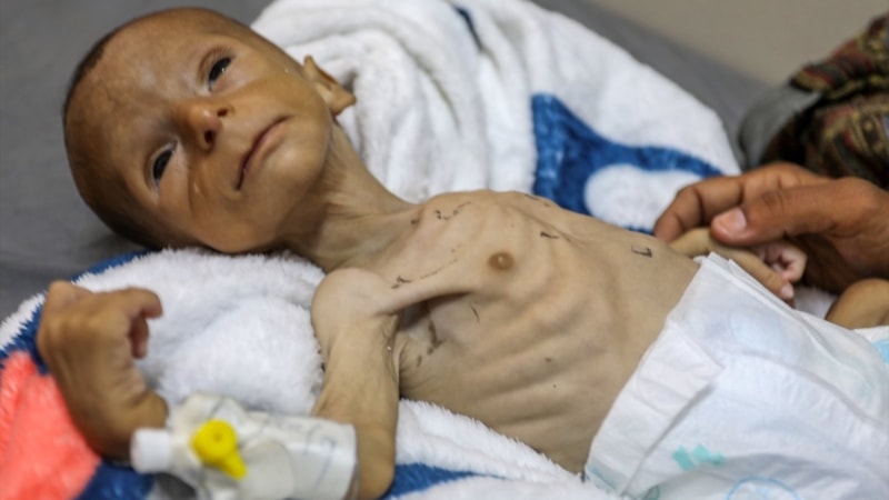 Gazze 'felaketi' yaşıyor: 2 aylık bebeğin yaşamı tehdit altında