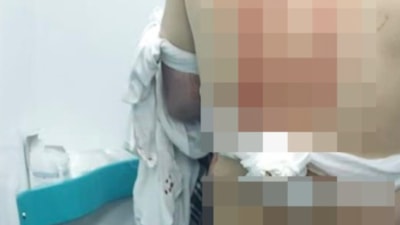 İstanbul'da abisini sokak ortasında silahla vurdu