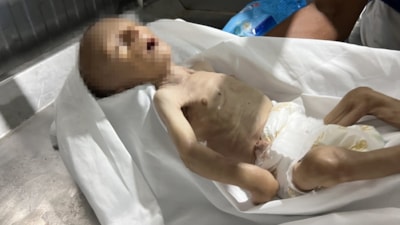 Gazze'de bir bebek daha açlıktan öldü