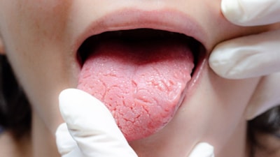 Dil vücudun aynası: Bu değişimlere dikkat