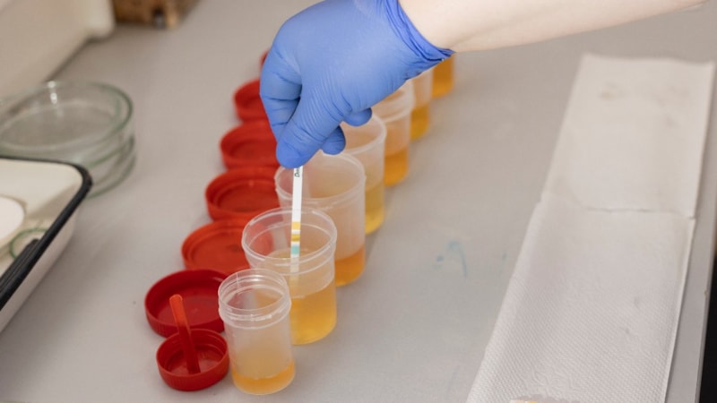 İdrarda bu detaya dikkat: Sağlıkla ilgili mesaj veriyor