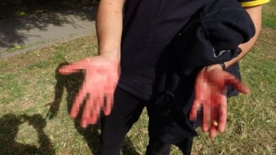 Antalya'da eline aldığı bıçakla yoldan geçen vatandaşlara saldırdı