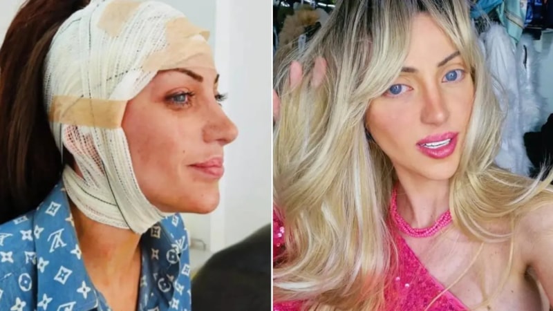 Barbie bebeğe benzemek için 27 kez ameliyat oldu: Brezilyalı fenomen 31 yaşında hayatını kaybetti