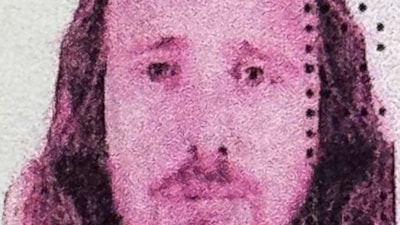 Saç ekimi ve diş tedavisi için Türkiye'ye geldi: İngiliz vatandaşı, hayatını kaybetti