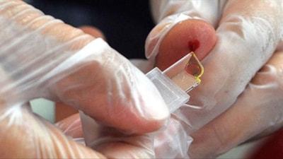 Yeni kan grubu üretiliyor: Sadece 50 kişide var