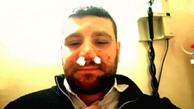 Ankara'da trafikte yol verme tartışması: Avukatın burnunu kıran şüpheli tutuklandı