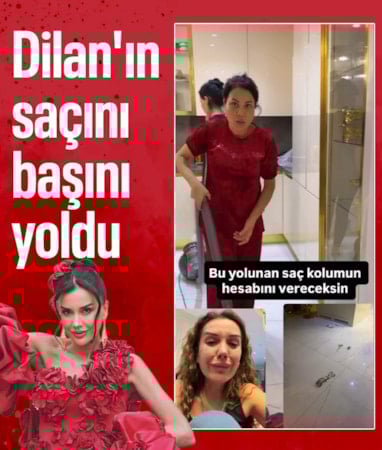 Dilan Polat dayak yedi