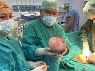 Amasya'da kadının şişen karnından 6 kiloluk kitle çıktı