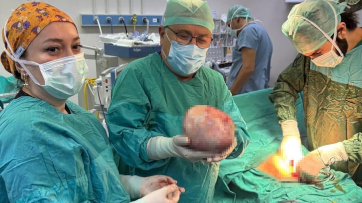 Amasya'da kadının şişen karnından 6 kiloluk kitle çıktı