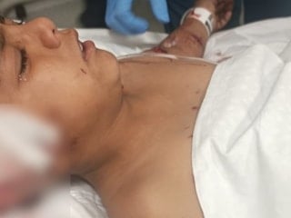 Ankara'da okul çıkışı sokak köpekleri saldırdı