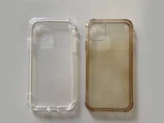 Bu yöntemi bilenler kılıf değiştirmiyor: Sarılığı anında yok ediyor