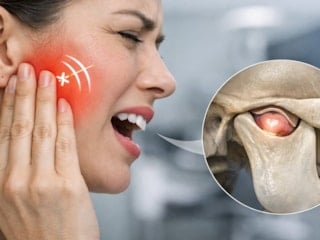 Çeneden gelen ses göz ardı edilirse çene kayması kronikleşebilir