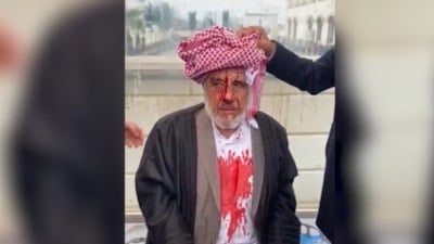 Şanlıurfa'da 72 yaşındaki adam sopalarla darbedildi