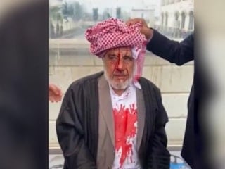 Şanlıurfa'da 72 yaşındaki adam sopalarla darbedildi