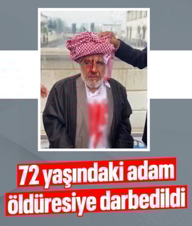 Şanlıurfa'da 72 yaşındaki adam sopalarla darbedildi