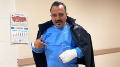 Sivas'ta meşhur tostçu, soğuk havada şov yapmak istedi: Kendini yaktı