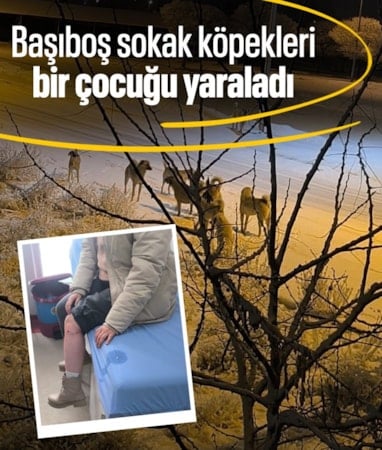 Kayseri'de sokak köpeğinin saldırdığı çocuk yaralandı