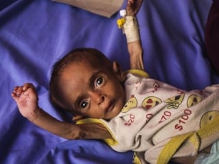 DSÖ: Gazze'de 18 bin 500'den fazla hastanın tahliye edilmesi gerekiyor