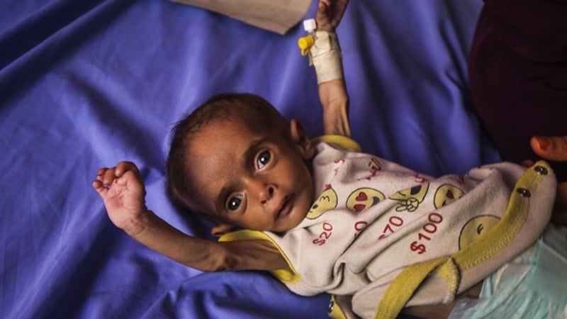 DSÖ: Gazze'de 18 bin 500'den fazla hastanın tahliye edilmesi gerekiyor