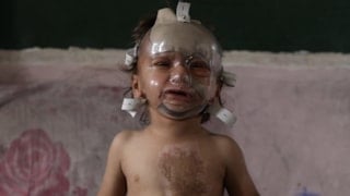 İsrail saldırılarında ağır yaralanan bebek tedavi bekliyor