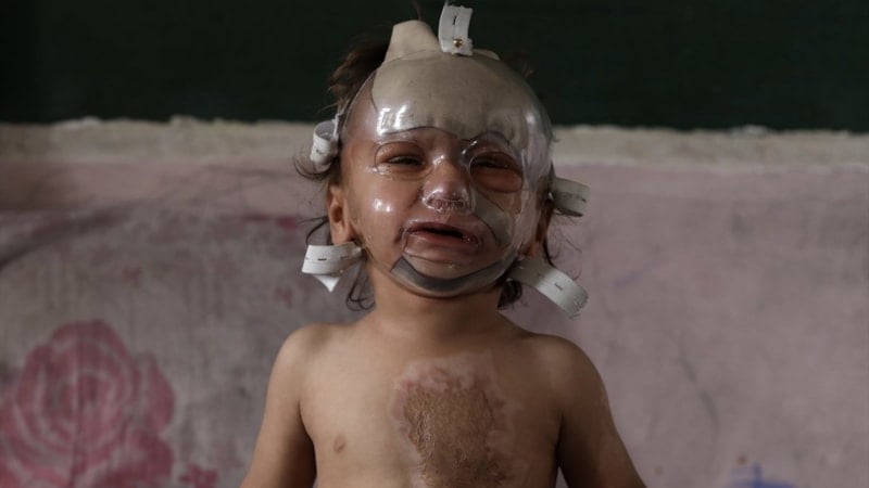 İsrail saldırılarında ağır yaralanan bebek tedavi bekliyor