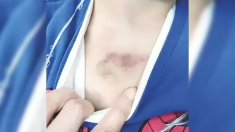 İBB'ye ait kreşteki darp ve istismar iddialarıyla ilgili tutuklama kararı